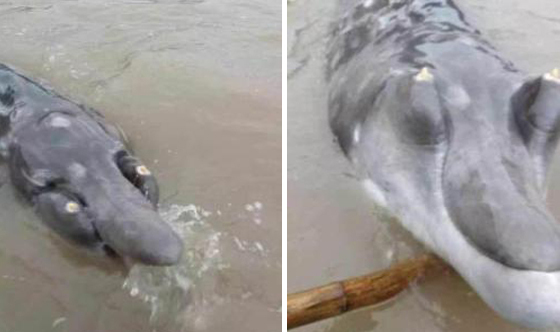 遭家暴 被丈夫割鼻女子 :等他归案了我就敢离婚